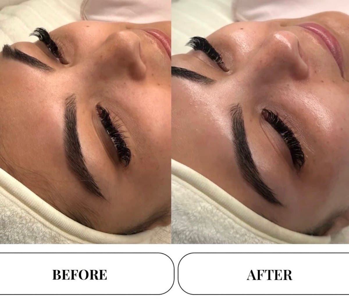 Client before and after facial treatment