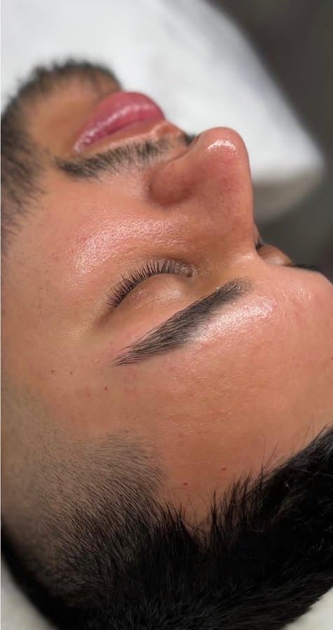 After facial treatment